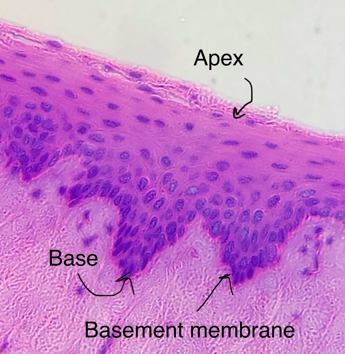 stratified squamous epithelium