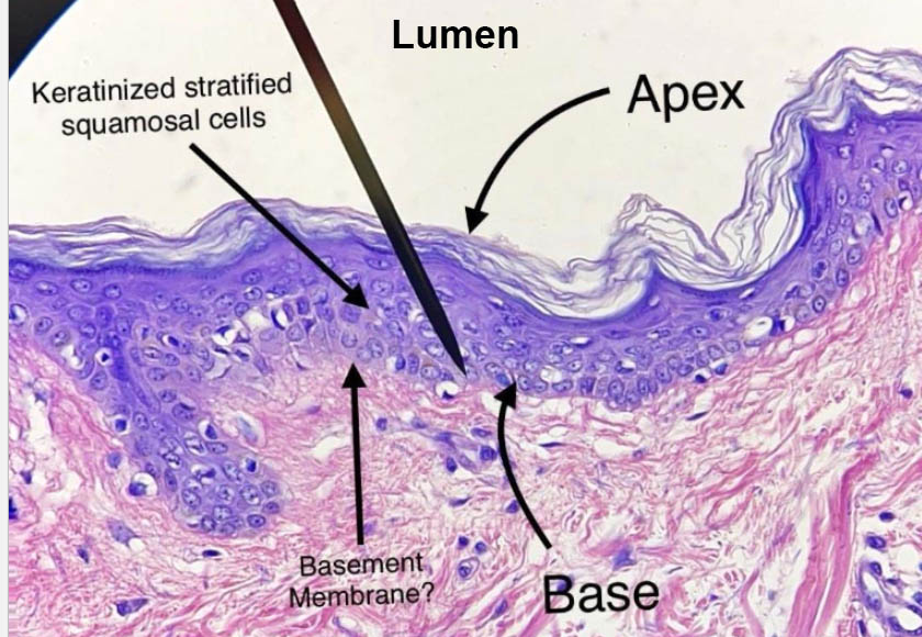 stratified squamous epithelium