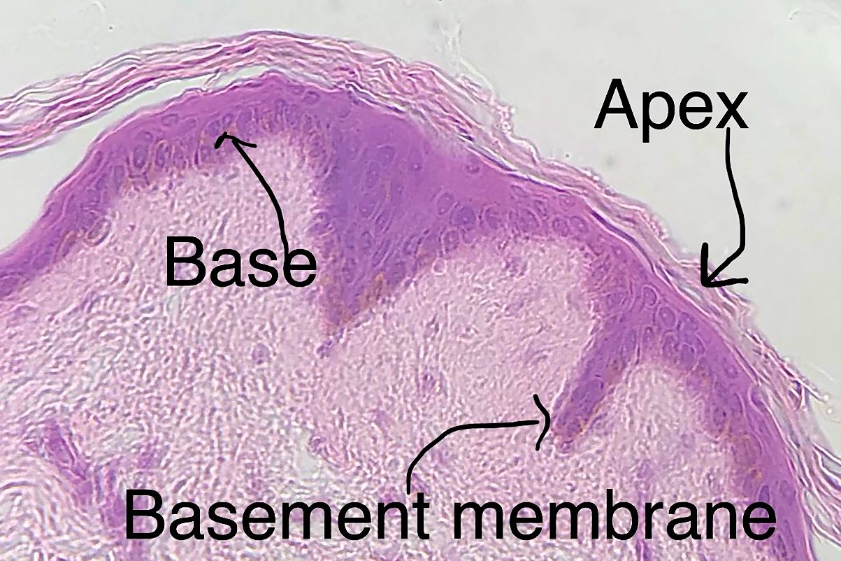 stratified squamous epithelium