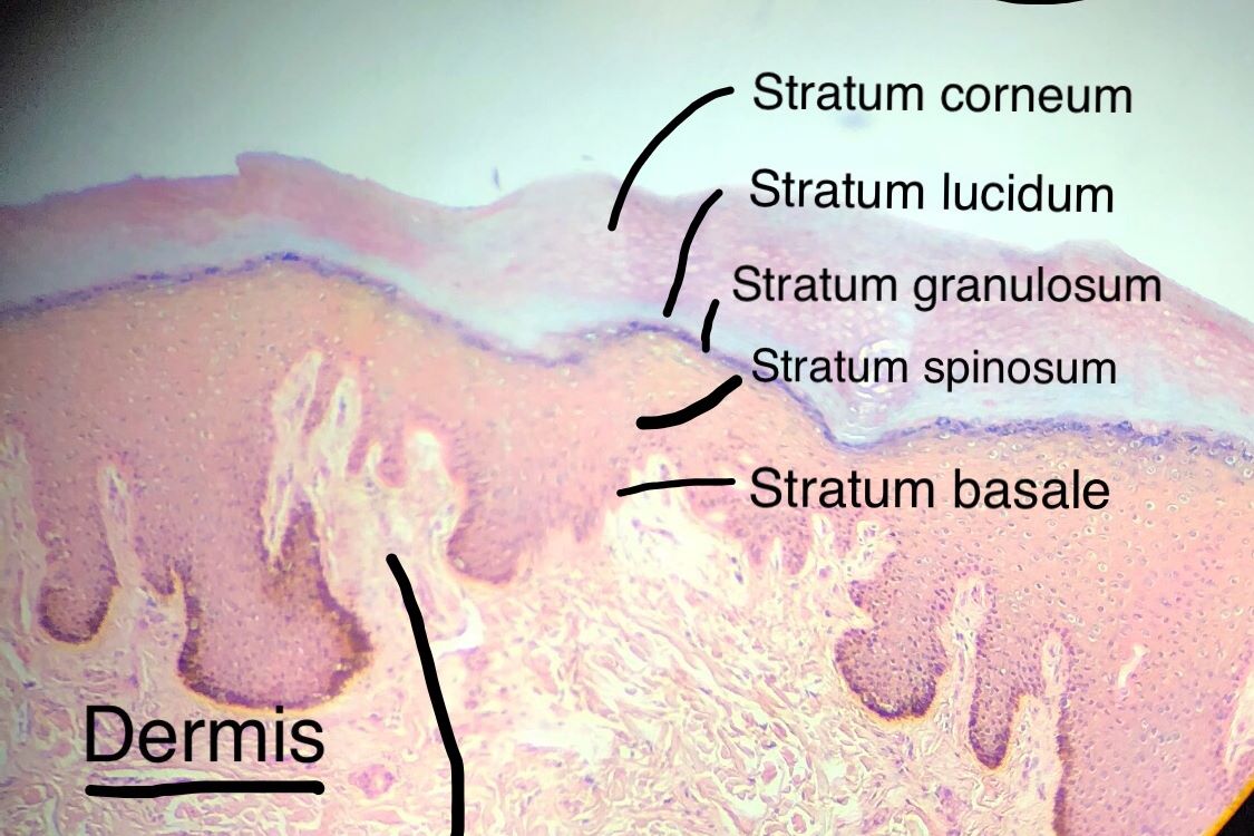 stratified squamous epithelium