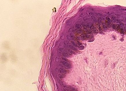 stratified squamous epithelium