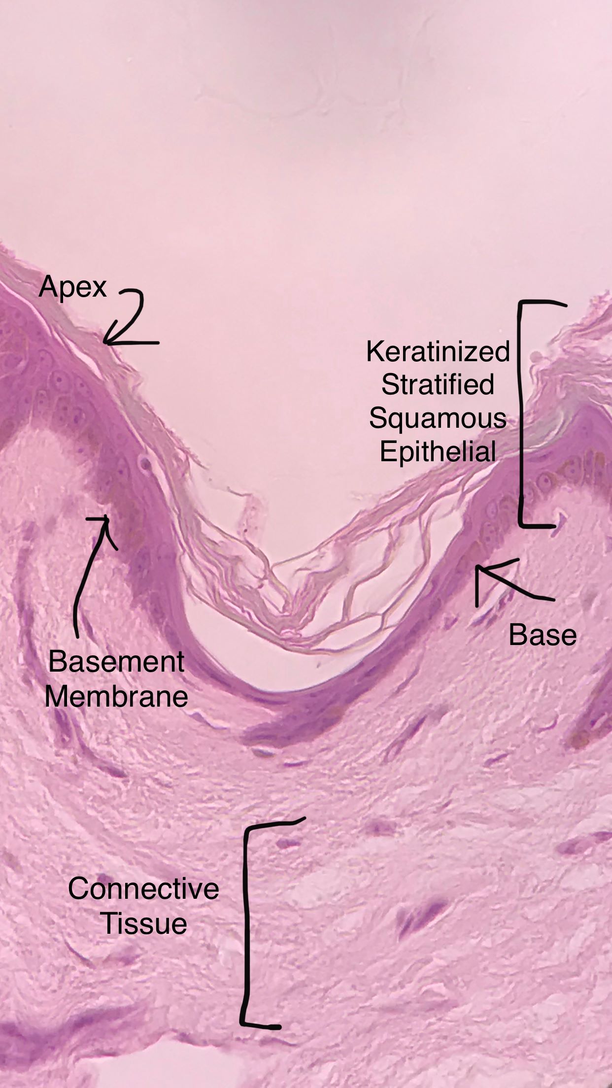 stratified squamous epithelium