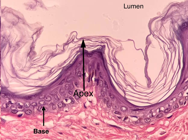 stratified squamous epithelium