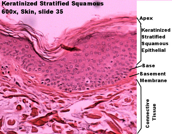 stratified squamous epithelium Labeled