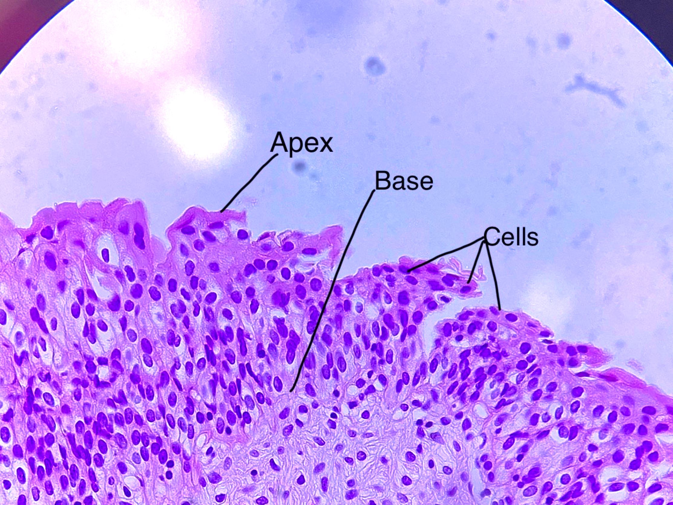 transitional epithelium