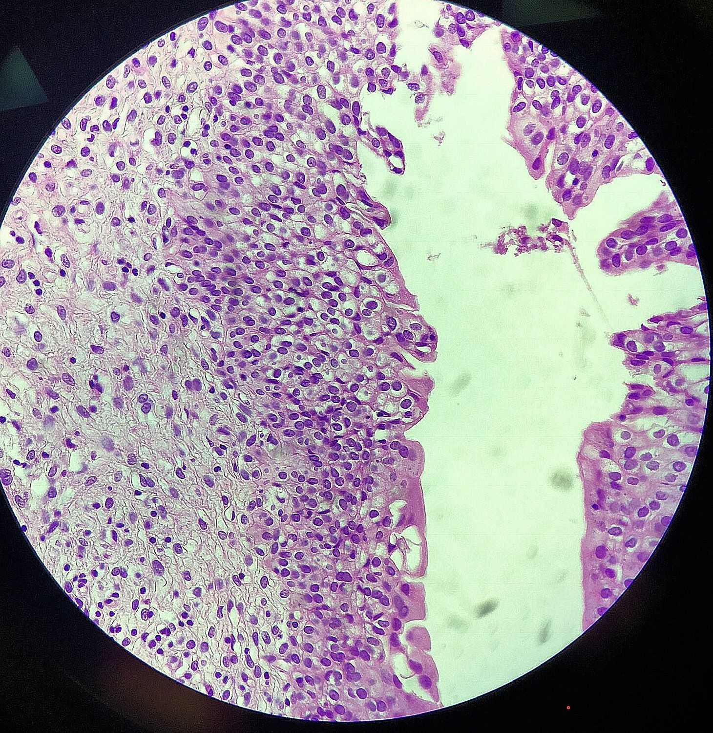 transitional epithelium