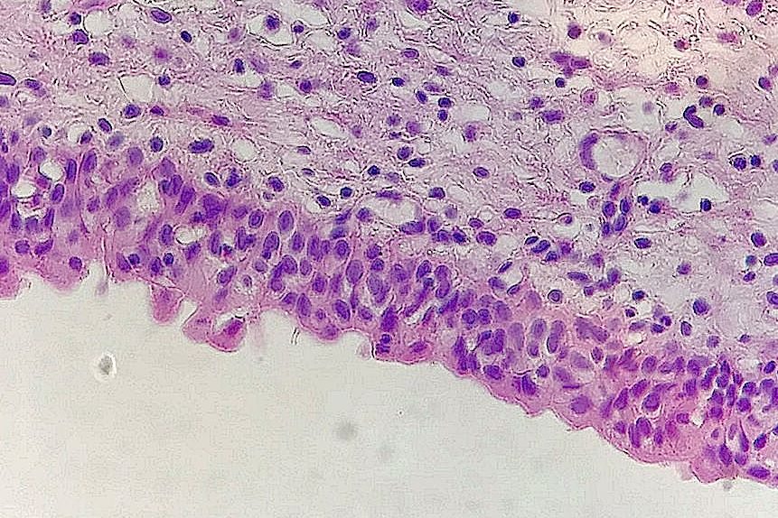 transitional epithelium