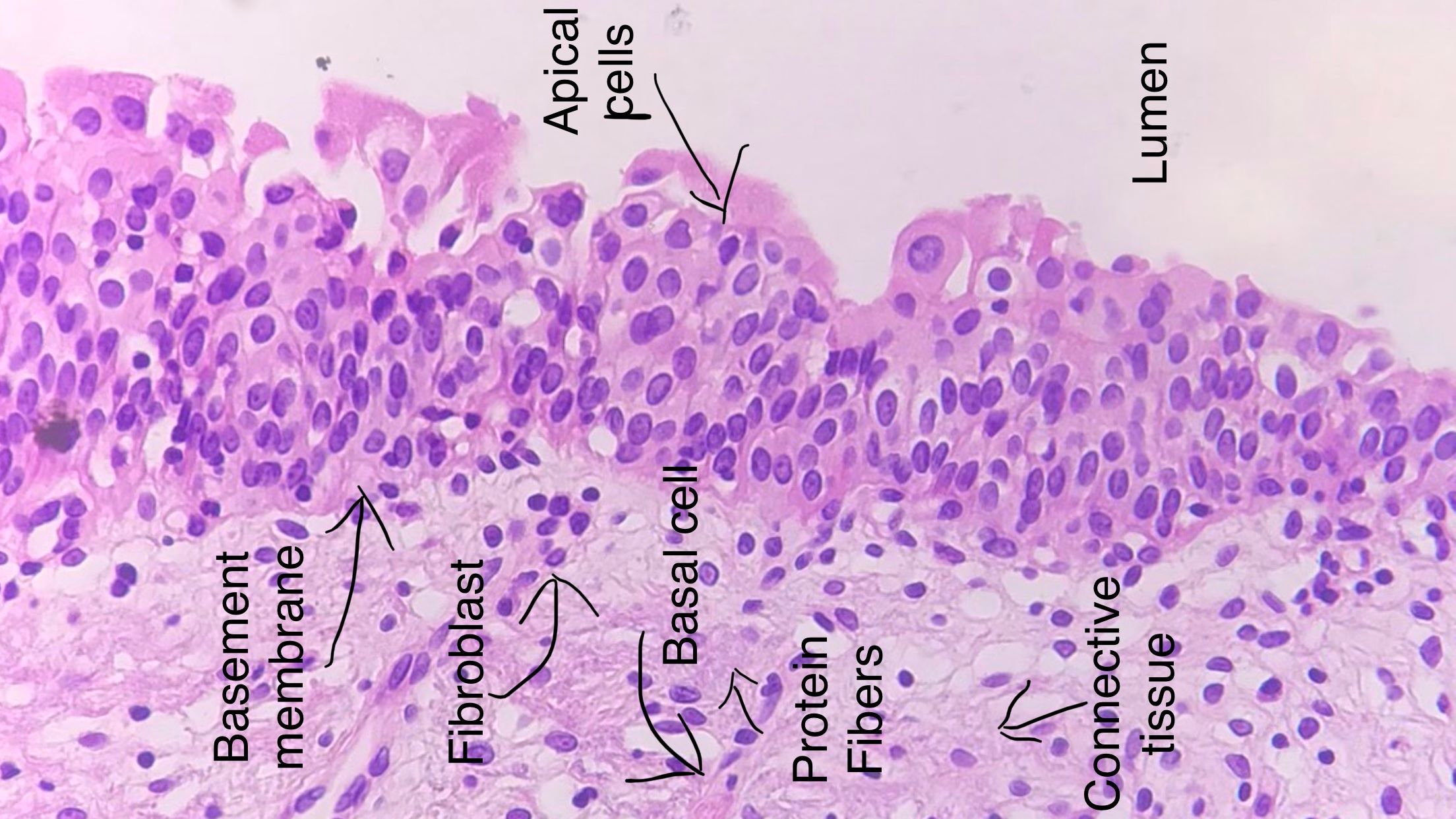 transitional epithelium