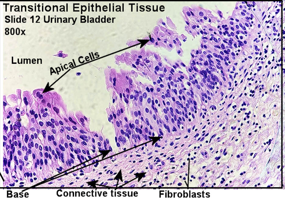 transitional epithelium Labeled