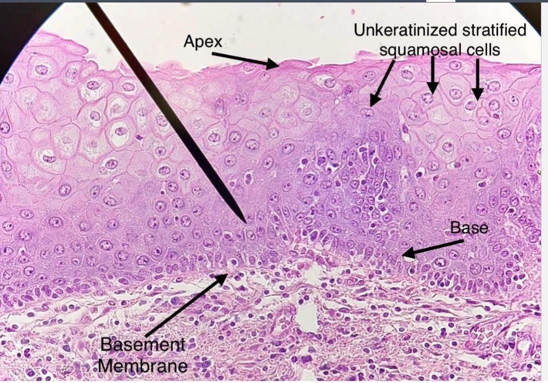 stratified squamous epithelium