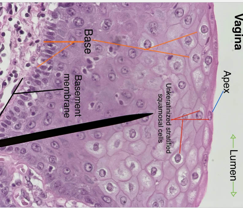 stratified squamous epithelium