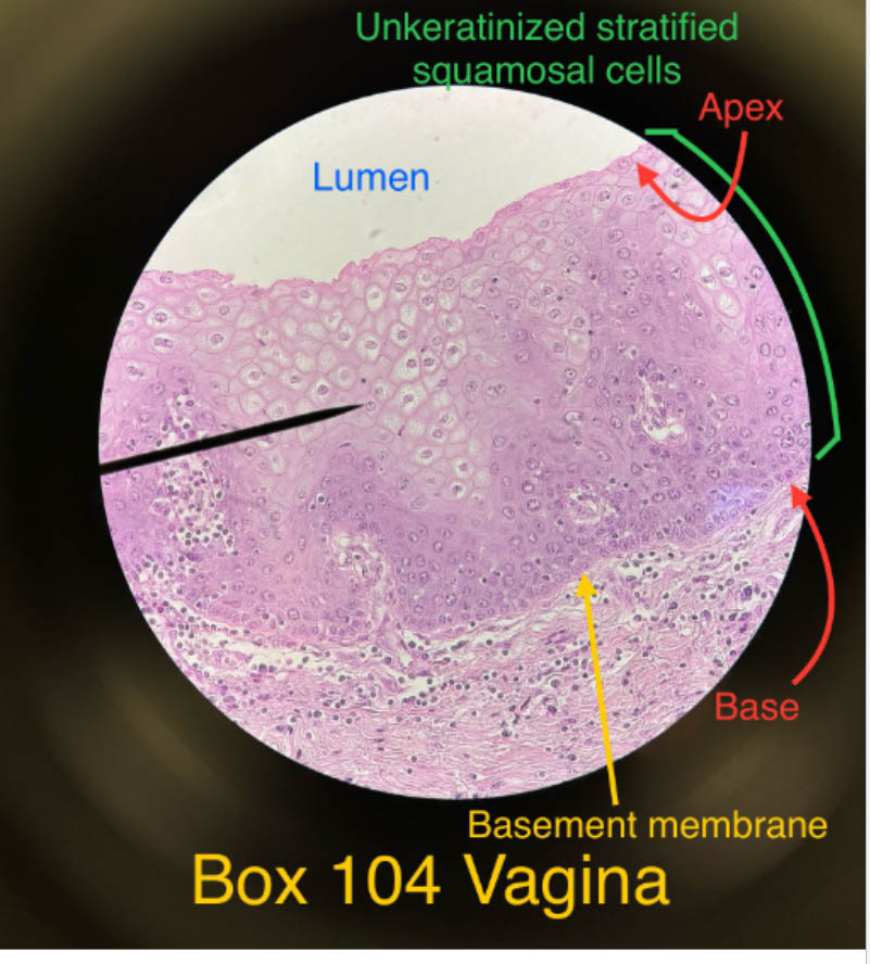 stratified squamous epithelium