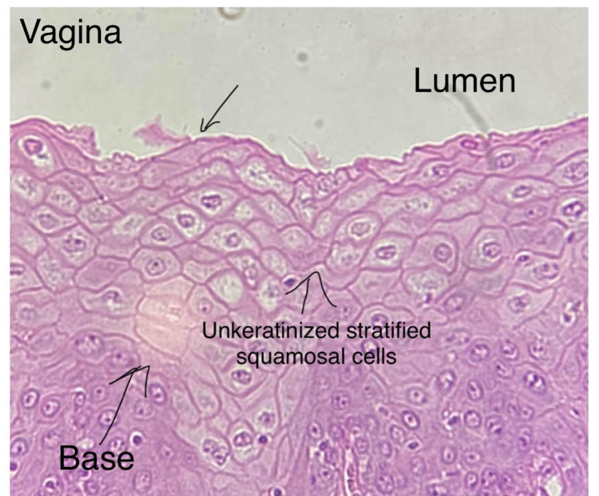 stratified squamous epithelium