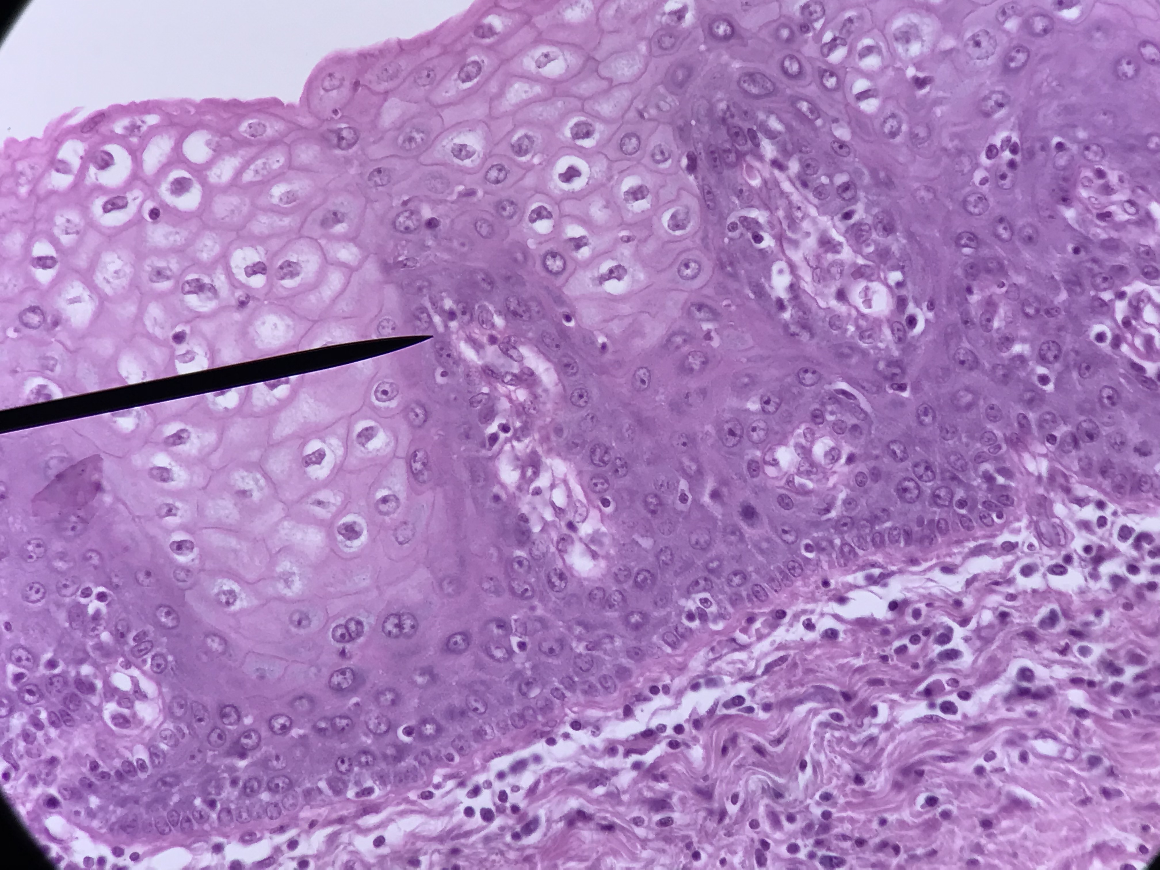 stratified squamous epithelium