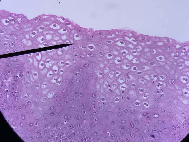 stratified squamous epithelium