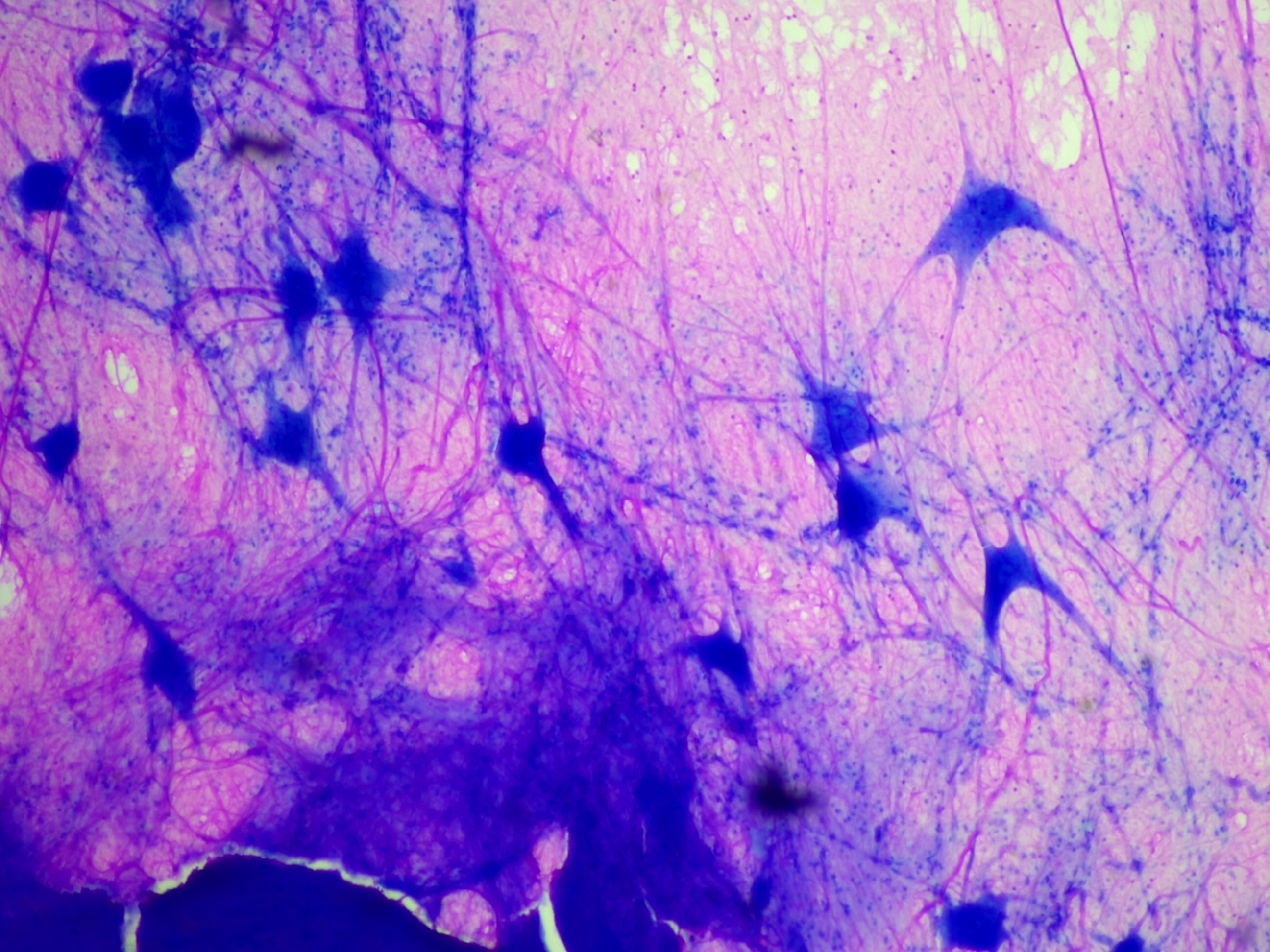 Spinal Multipolar Neurons