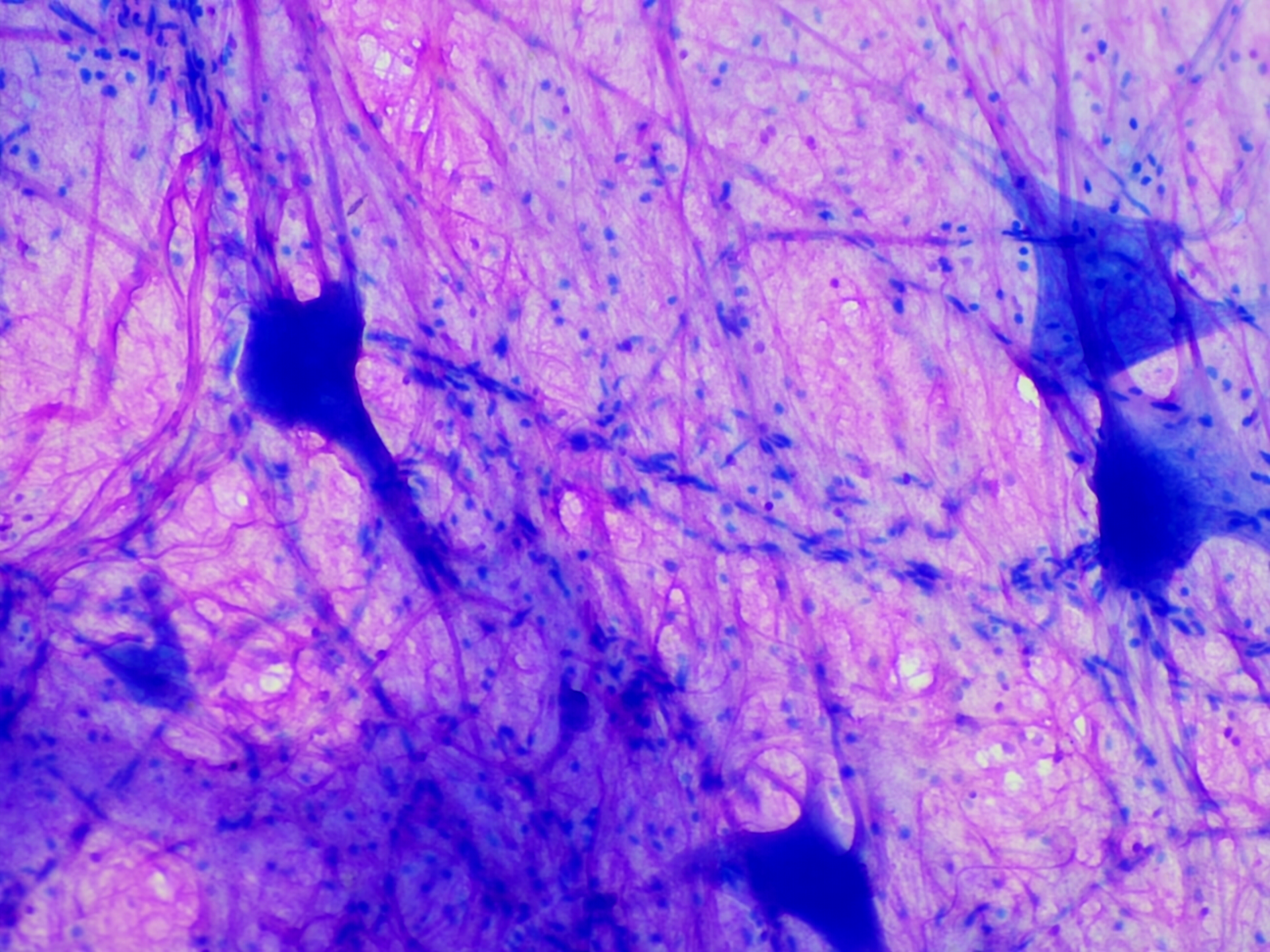 Spinal Multipolar Neurons