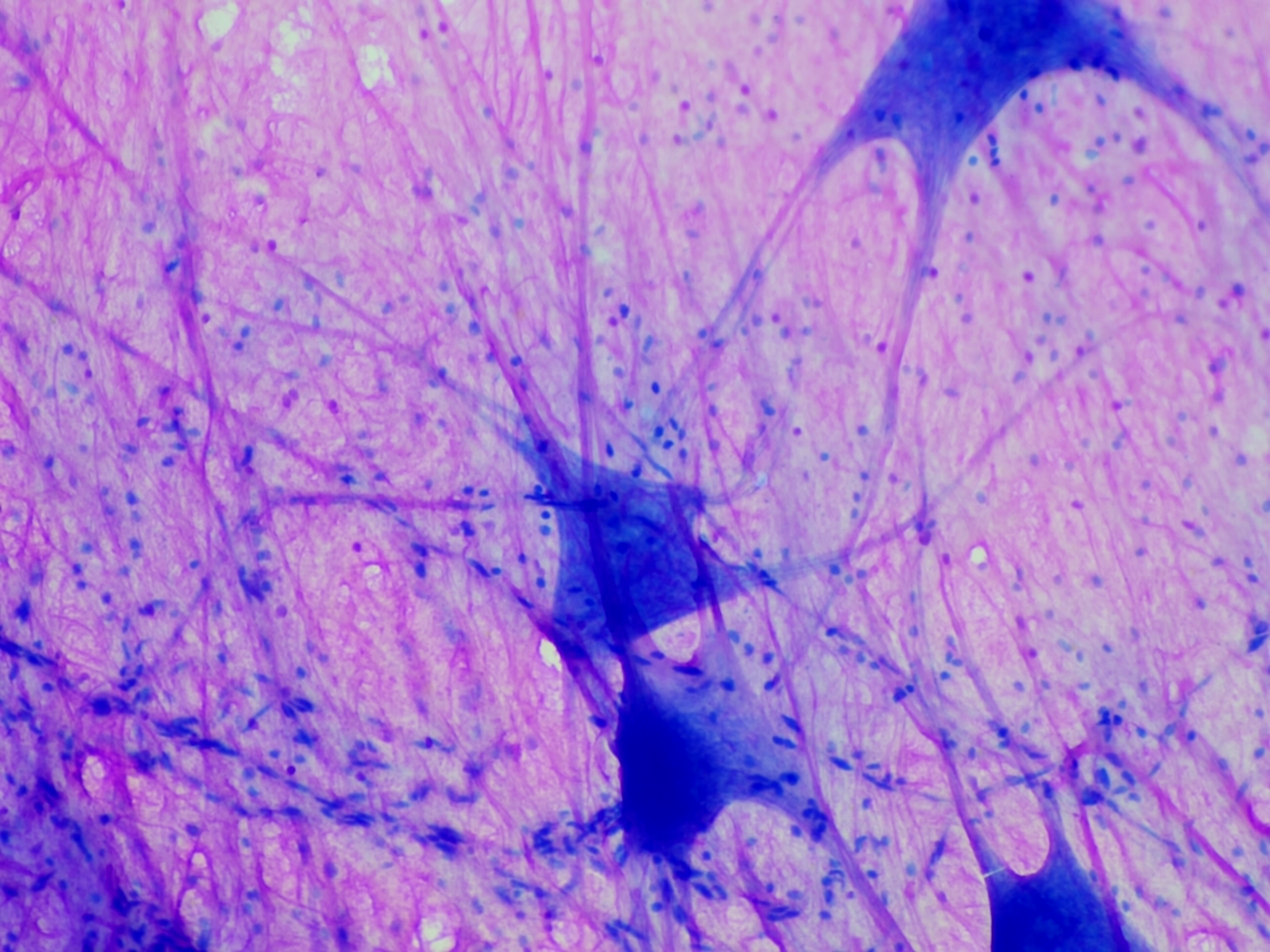 Spinal Multipolar Neurons