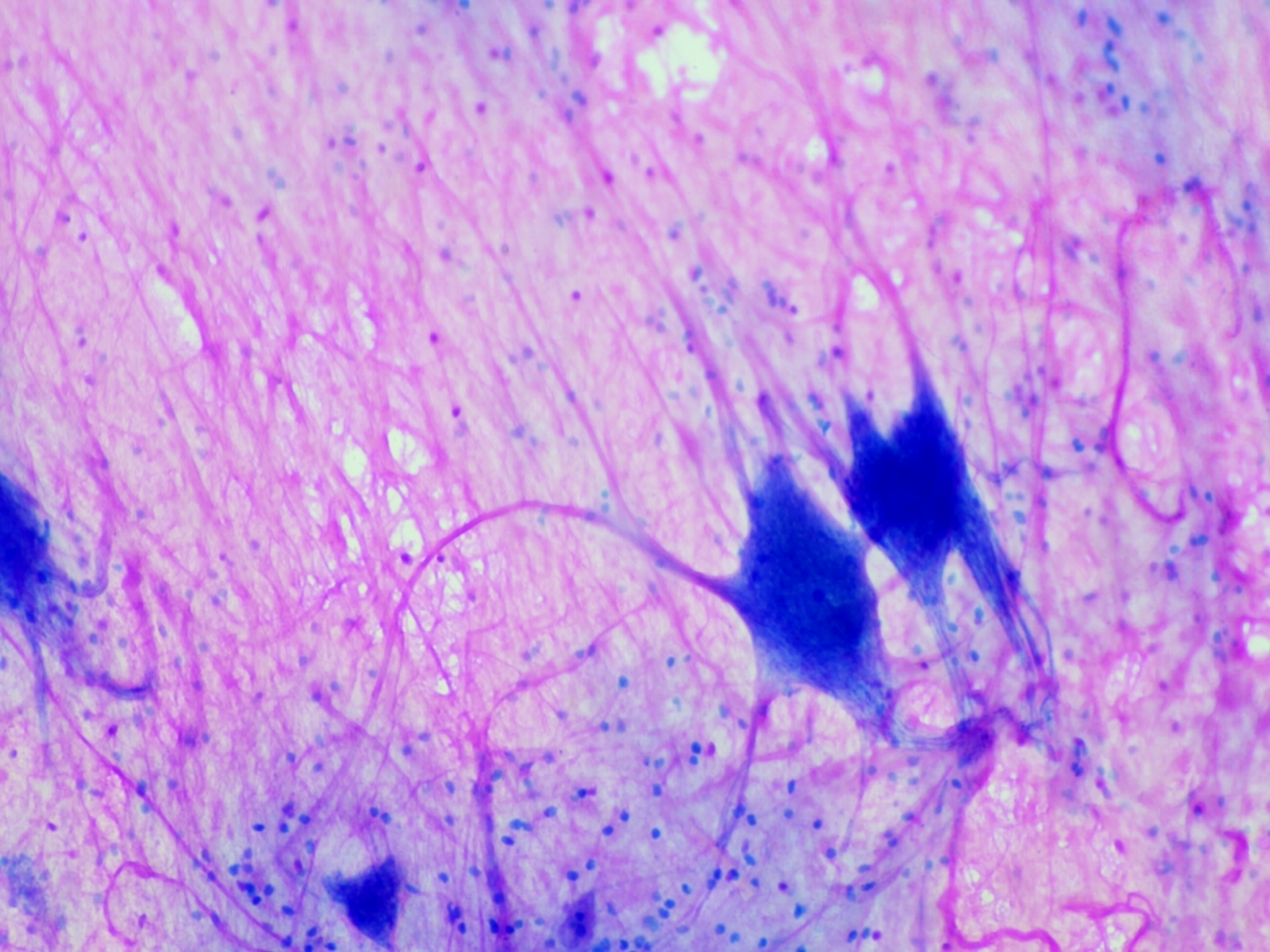 Spinal Multipolar Neurons