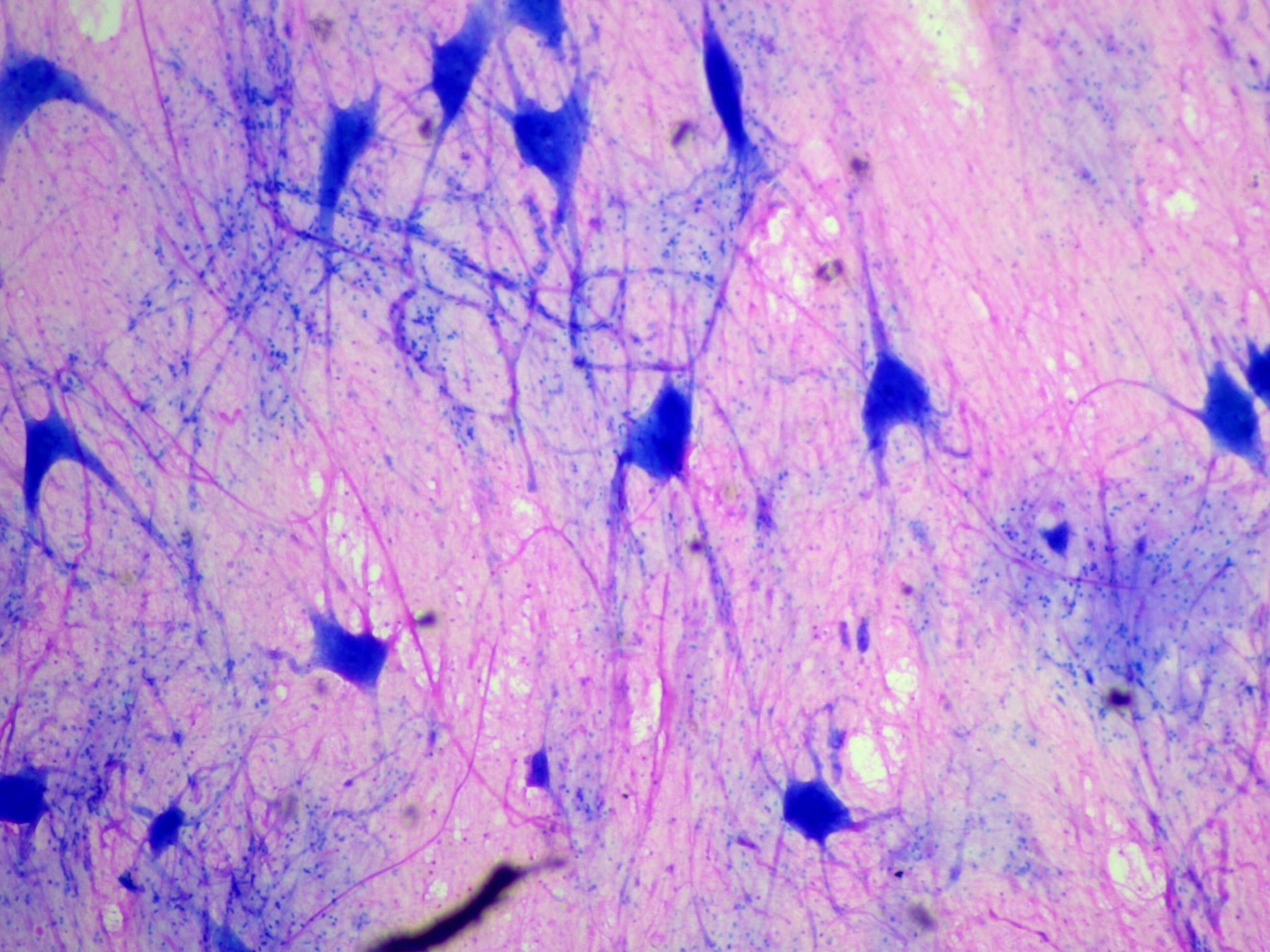 Spinal Multipolar Neurons