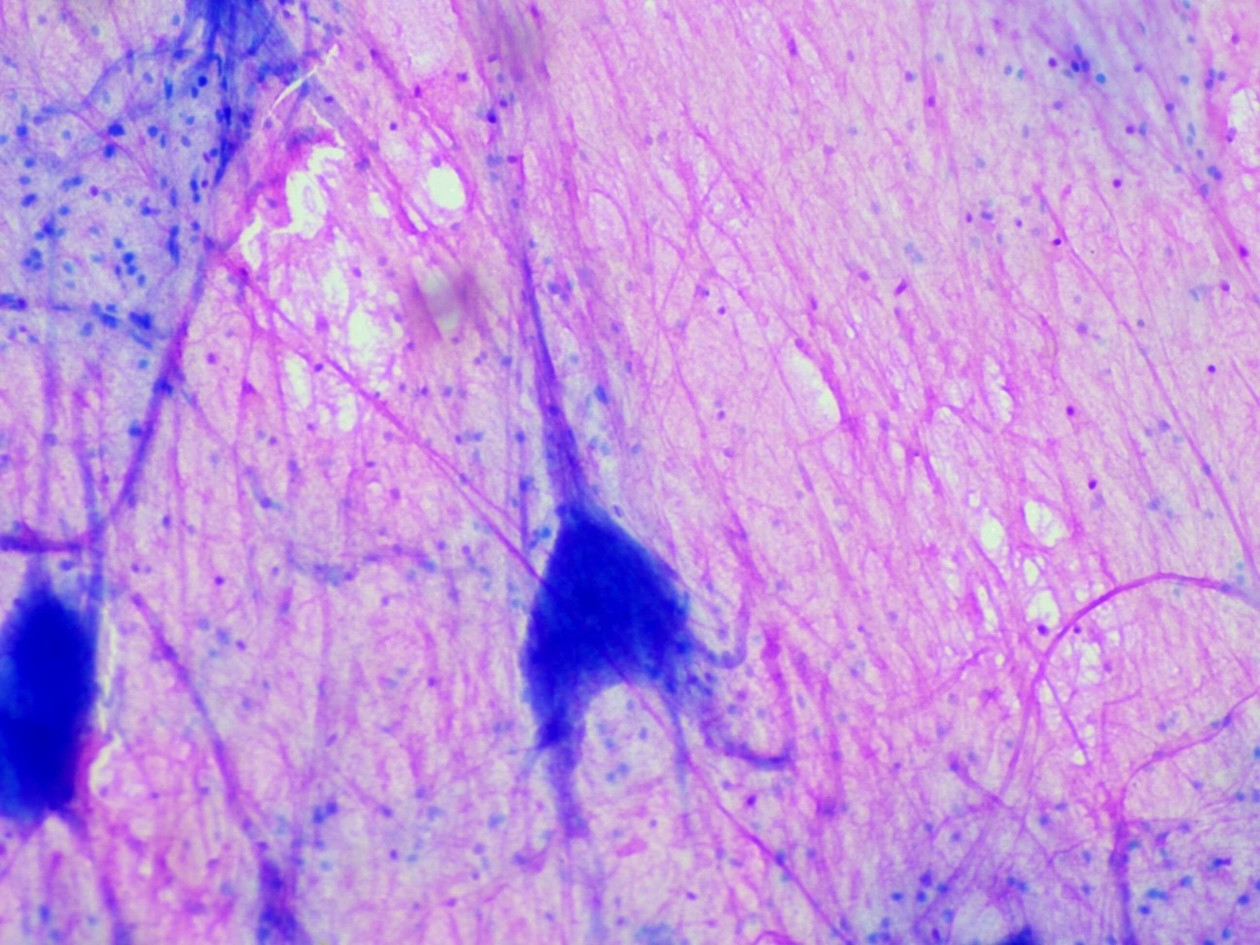 Spinal Multipolar Neurons