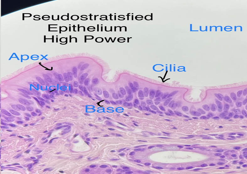 Cilliated epithelial cells from the trachea