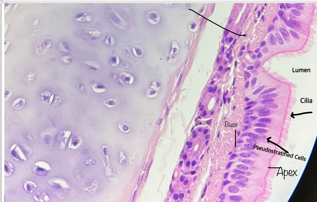 Cilliated epithelial cells from the trachea