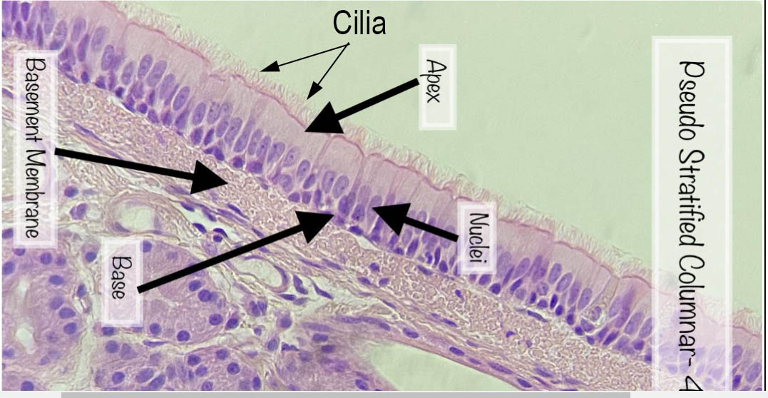 Cilliated epithelial cells from the trachea