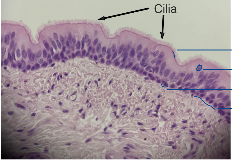 Cilliated epithelial cells from the trachea