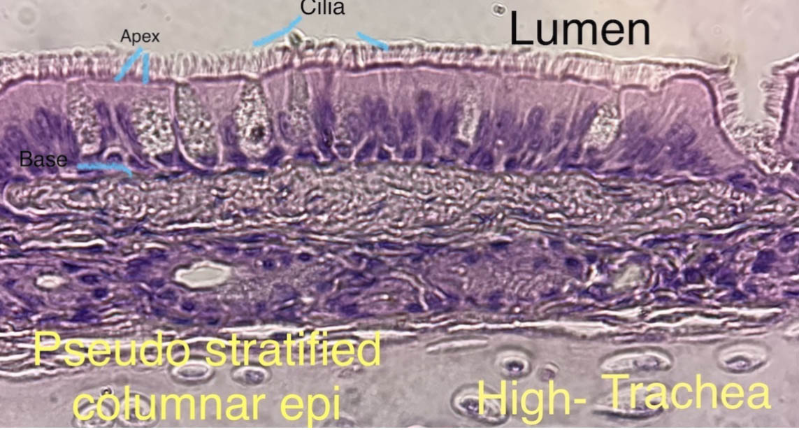 Cilliated epithelial cells from the trachea