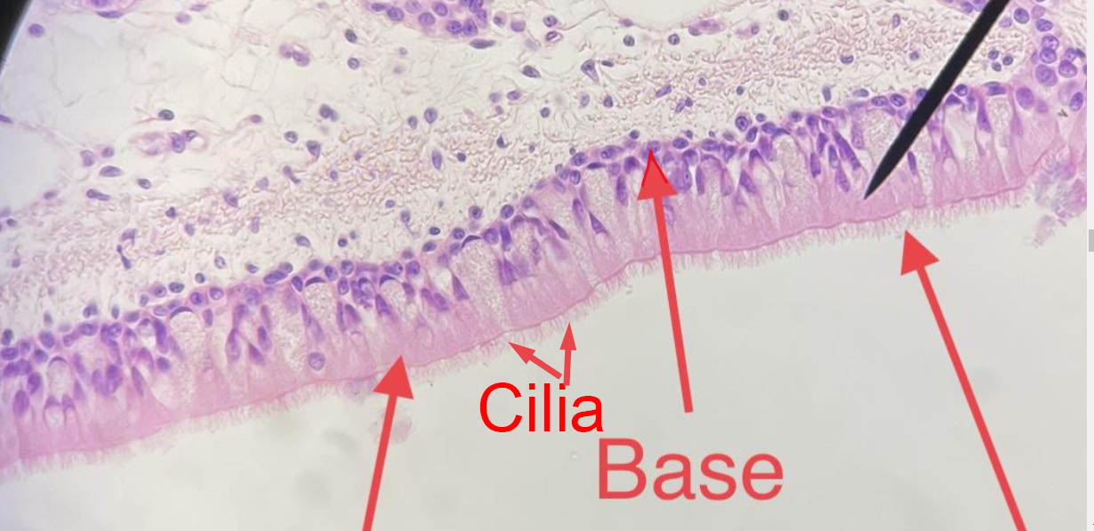 Cilliated epithelial cells from the trachea