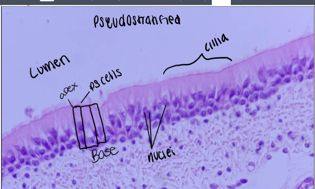 Cilliated epithelial cells from the trachea