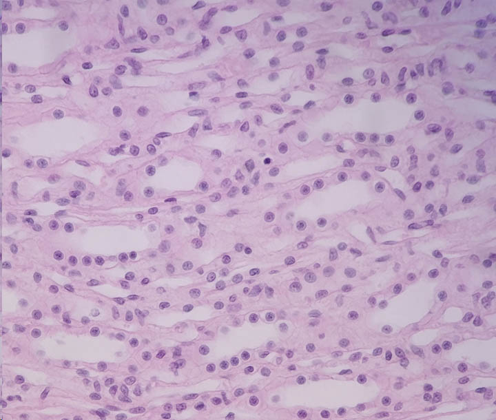 Simple cuboidal epithelium