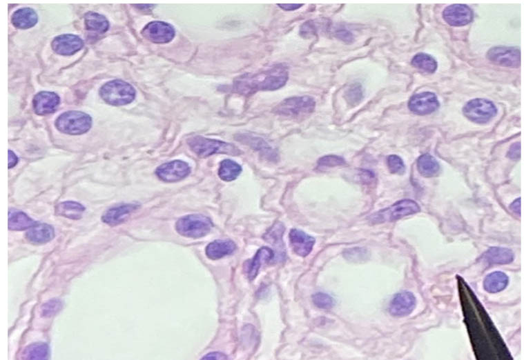 Simple cuboidal epithelium