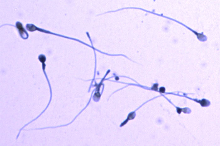 Microvilli in the intestines