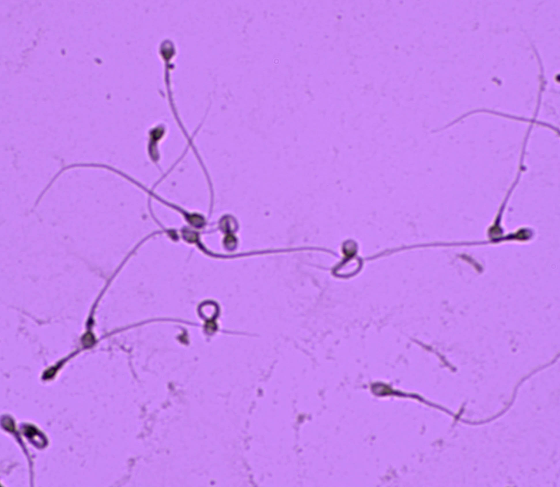 Microvilli in the intestines