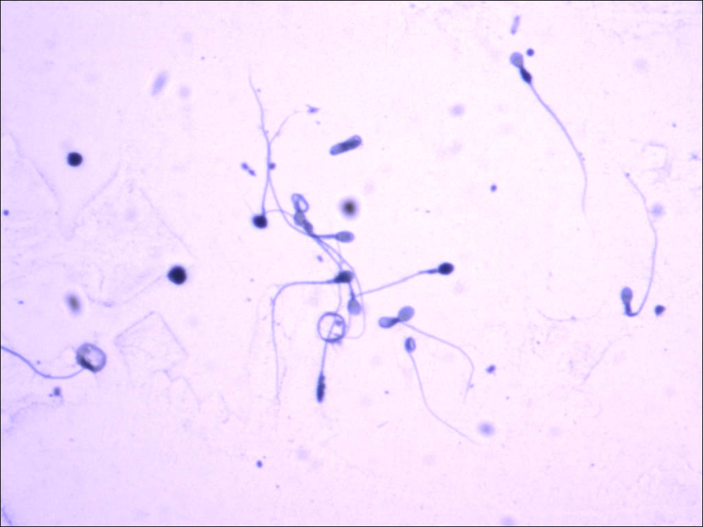 Microvilli in the intestines