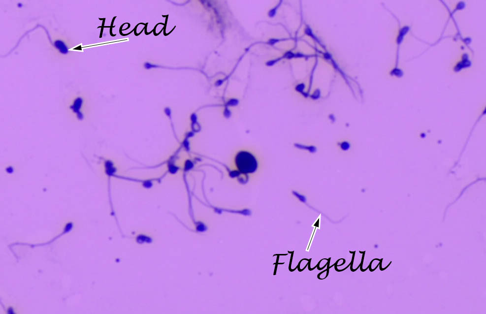 Microvilli in the intestines