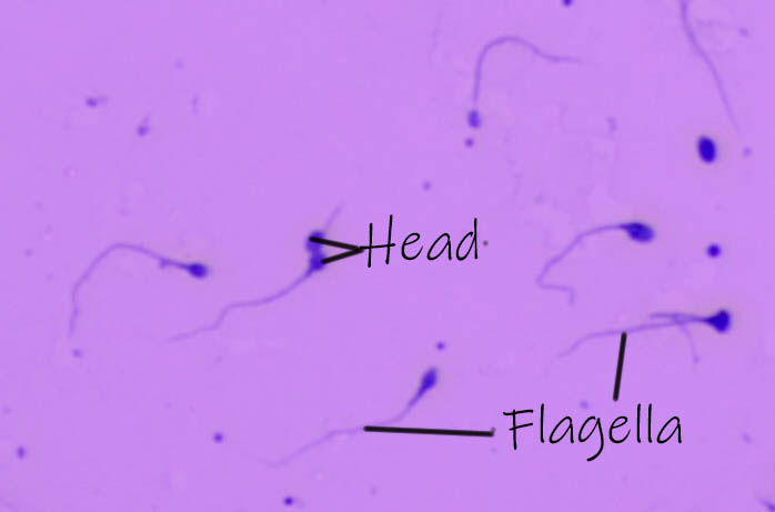 Microvilli in the intestines