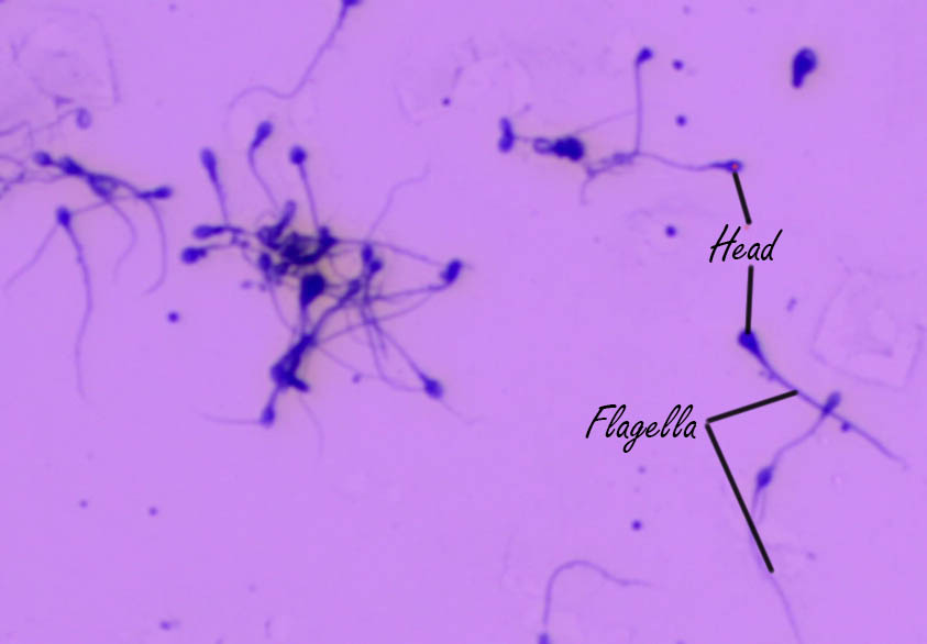 Microvilli in the intestines