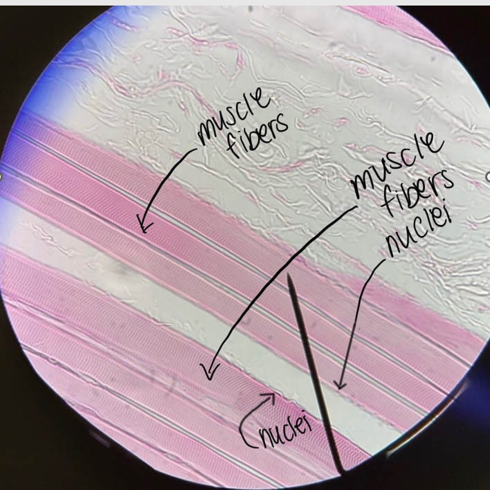 Skeletal muscle fibers