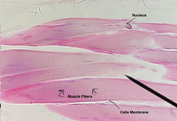 Skeletal muscle fibers