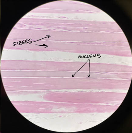 Skeletal muscle fibers