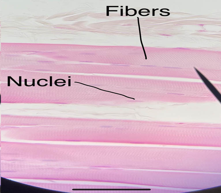 Skeletal muscle fibers