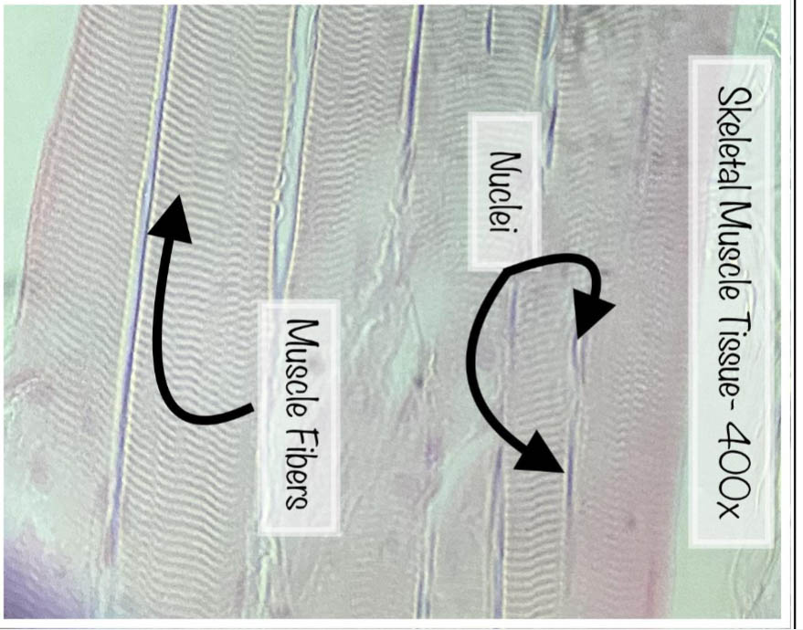 Skeletal muscle fibers