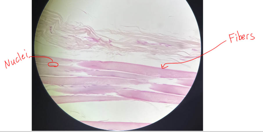 Skeletal muscle fibers