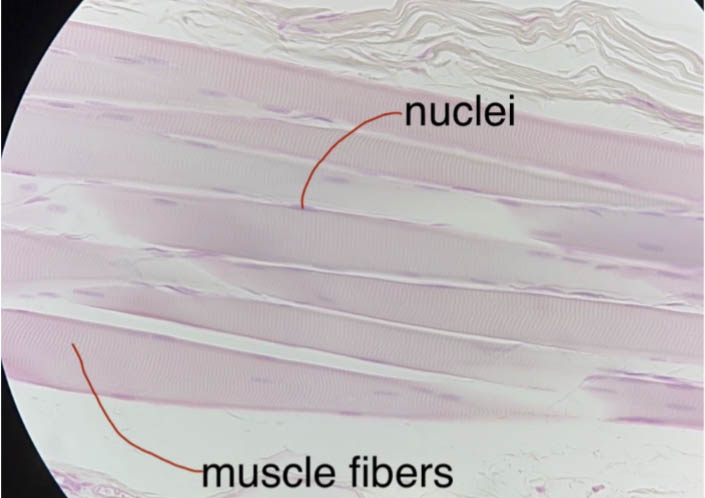 Skeletal muscle fibers