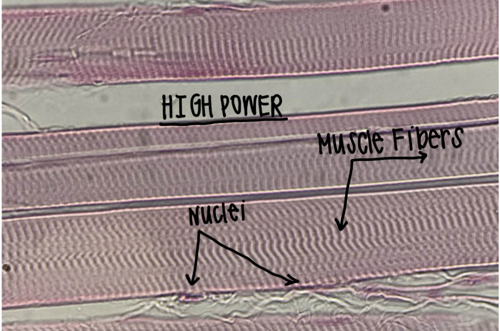 Skeletal muscle fibers