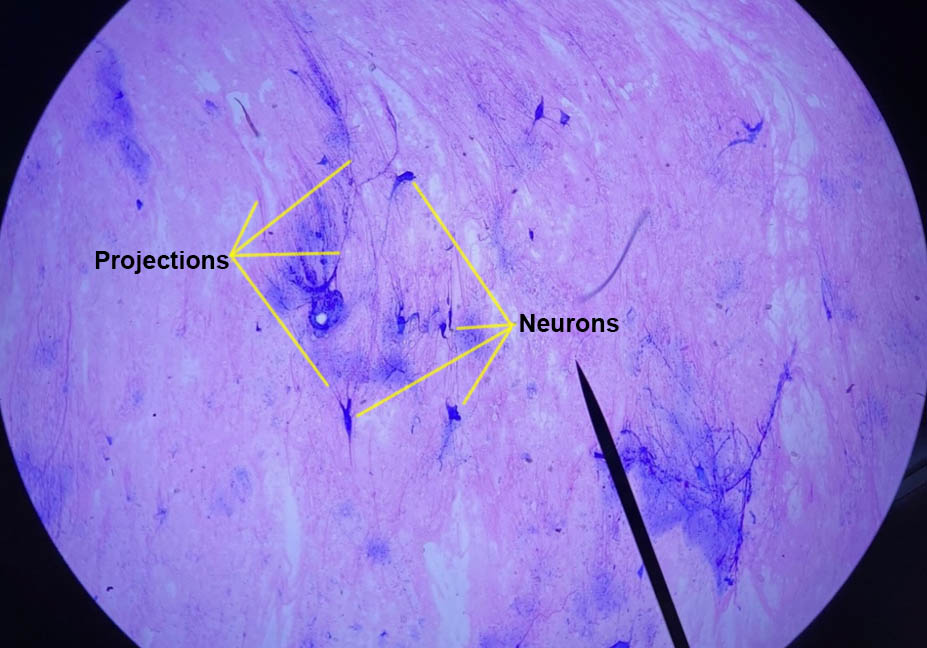 Multipolar Neurons