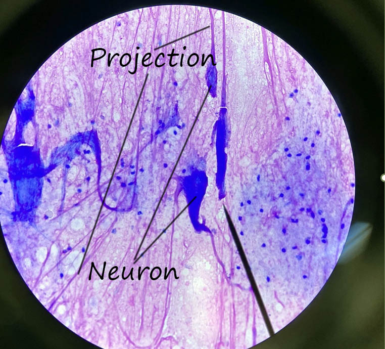 Multipolar Neurons